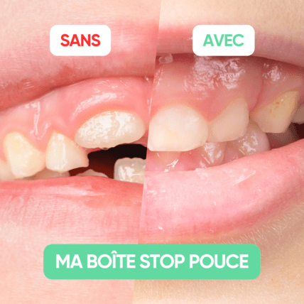 Avis MA BOÎTE STOP POUCE La Tribu Happy Kids 6