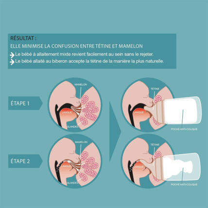 Avis Tétines Zero Zero Pour Biberon Anti Colique Suavinex 3