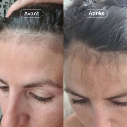 Avis Mon Coup de Pousse Nutricosmétique OMUM 3