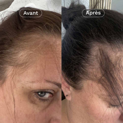 Avis Mon Coup de Pousse Nutricosmétique OMUM 4