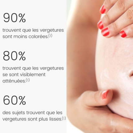 Avis Baume SOS Vergetures Laboratoires Téane 4