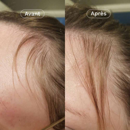 Avis Mon Coup de Pousse Nutricosmétique OMUM 5