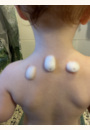 avis CALM Mousse anti-démangeaisons par coralia