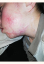 avis Huile Vergetures par Laura