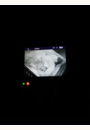 avis Ecoute bébé vidéo numérique SCD845/26 par Mathilde