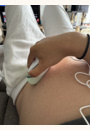 avis Moniteur de rythme cardiaque fœtal - Echö par Coraline