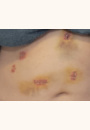 avis Cicaplast - Accélérateur de réparation épidermique par Alexandra