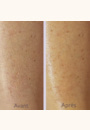 avis CALM Mousse anti-démangeaisons par Léa