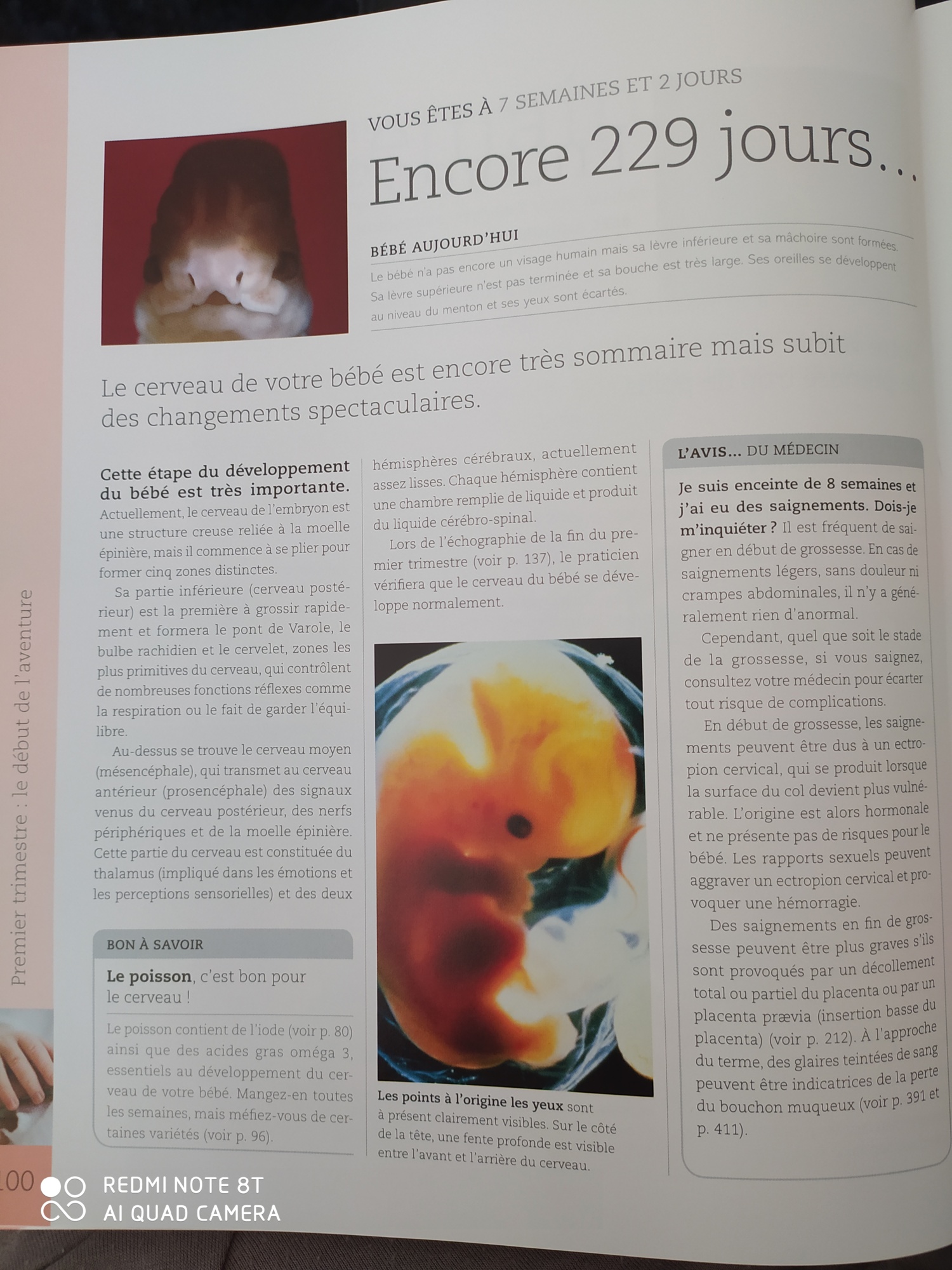 Pré-visualisation