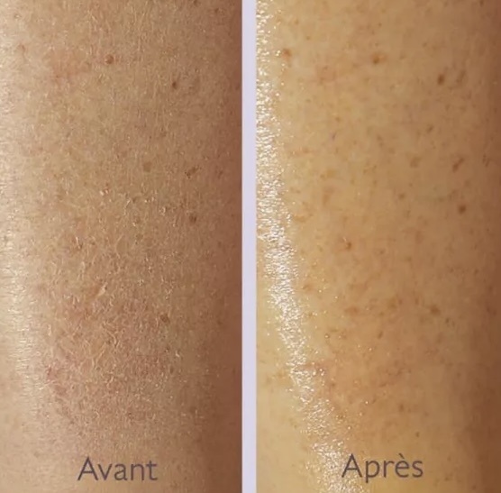 Pré-visualisation