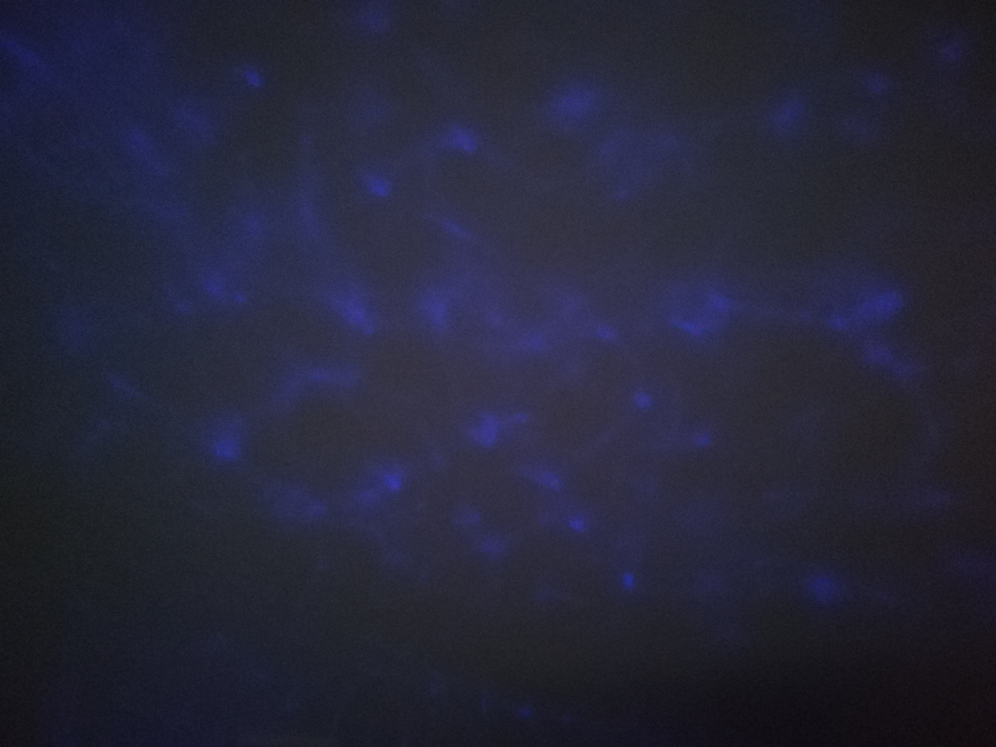 Pré-visualisation